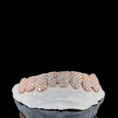 10K Rose Gold Teeth Grill with Lab Grown Diamond Studded